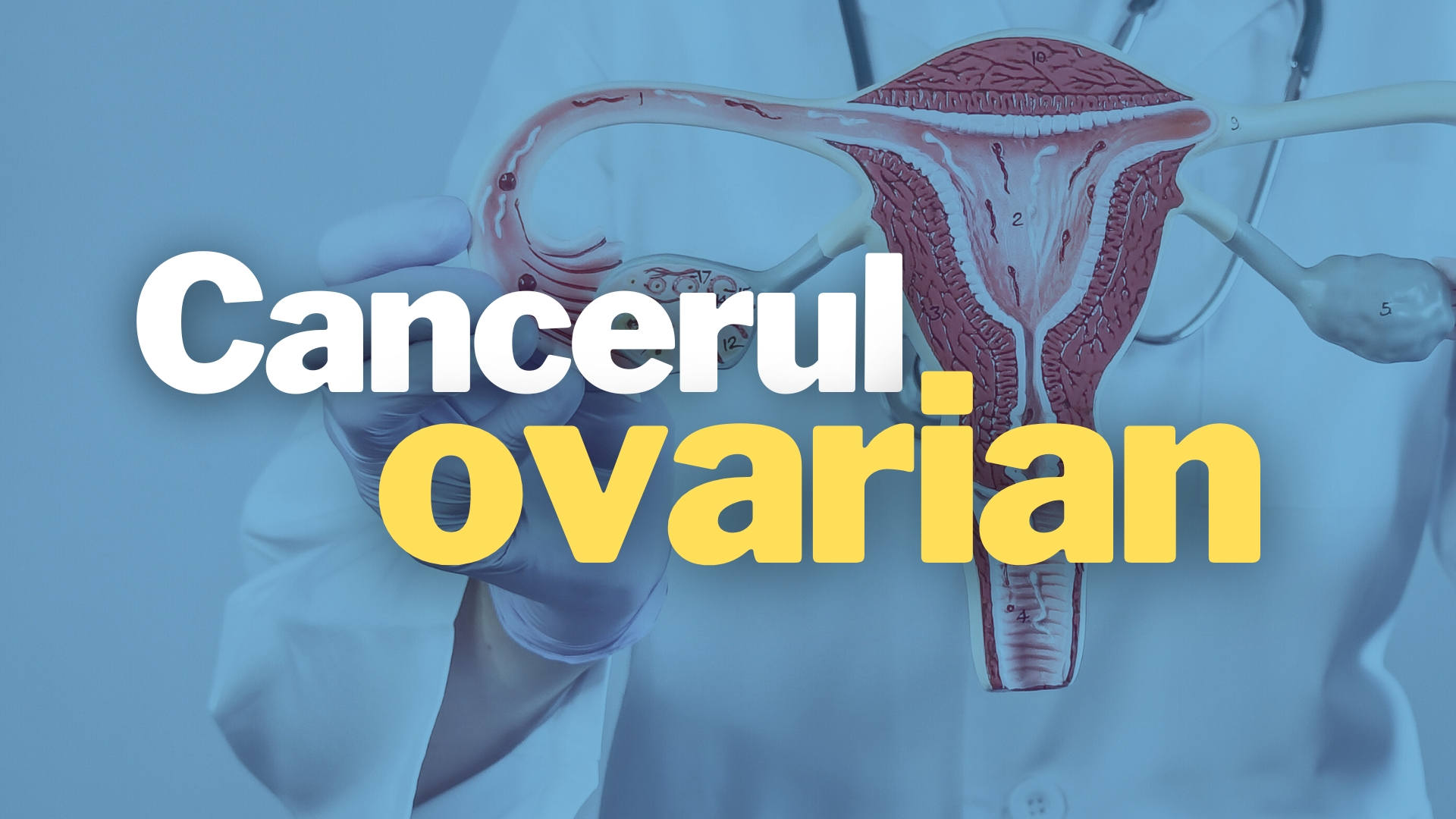 Cancerul ovarian ucid anual peste 1.100 de femei în România