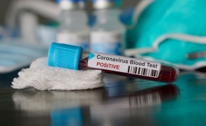 OFICIAL - Câte teste pentru coronavirus au fost efectuate în România