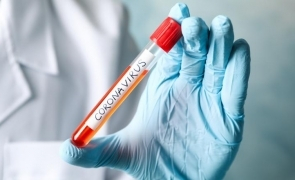Nouă motive care să ne calmeze frica de coronavirus