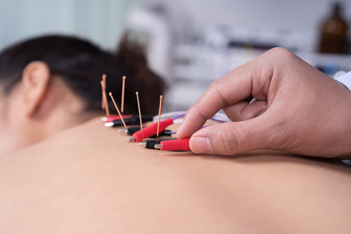  Electroacupunctura te scapă de dureri. Bonus, ajutor în frumusețe