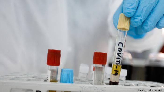 Institutul Cantacuzino a lansat un produs ce poate lupta eficient cu noul coronavirus. Cum se administrează și când va putea fi cumpărat