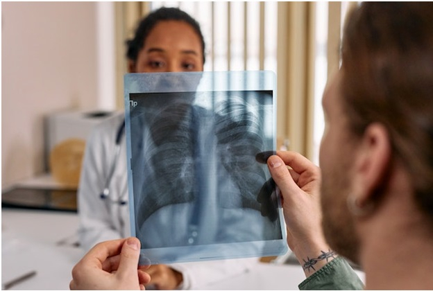 Testările pulmonare gratuite continuă