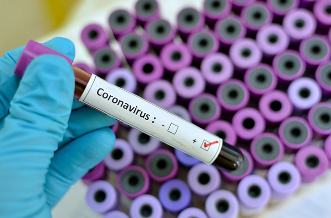 Cum afli sigur dacă ai COVID-19. Prof. dr. Ileana Constantinescu: Asta trebuie făcut / VIDEO