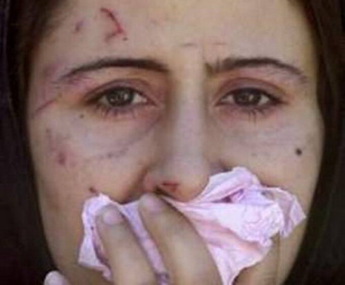 Nevastă de 18 ani, înjungiată de propriul soț. A refuzat să depună plângere