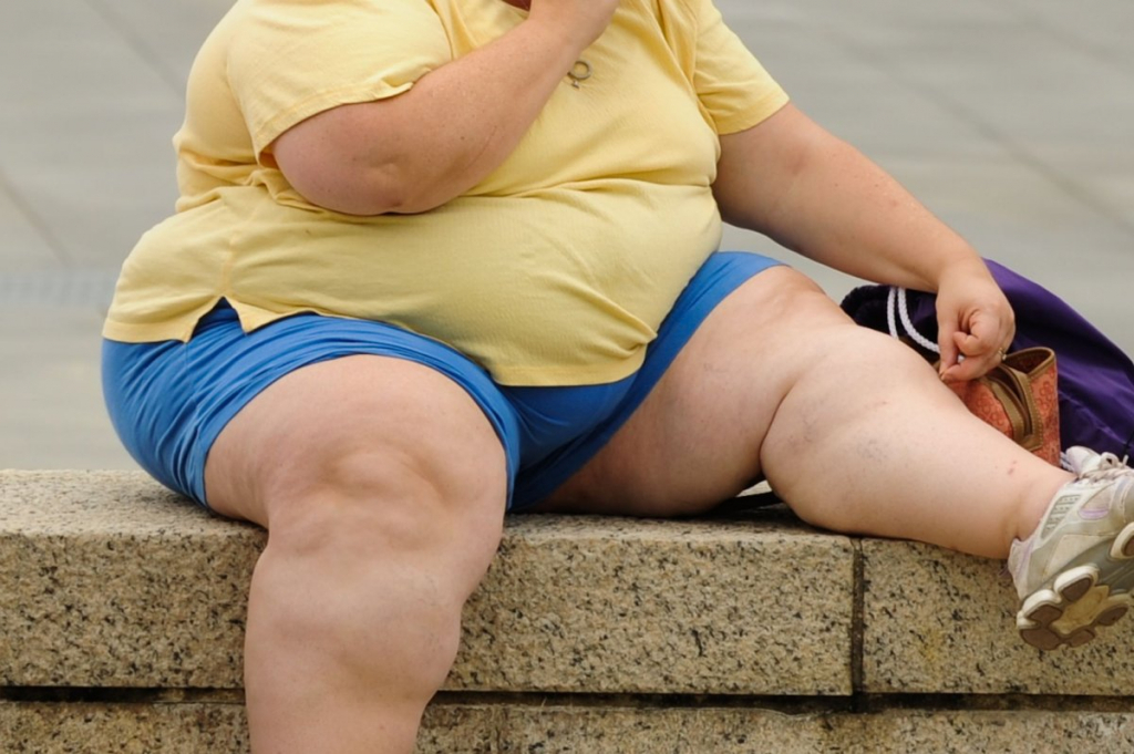 Aproape un sfert dintre români sunt obezi