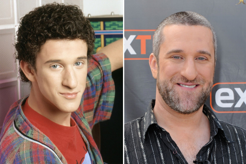 Adevărata cauză a cancerului pulmonar de care a murit Dustin Diamond, cunoscut pentru rolul lui Screech. Actorul nu a fumat niciodată 