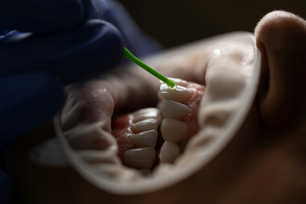 Delta Clinic Dent îți dezvăluie: Cum să îți păstrezi zâmbetul alb fără proceduri costisitoare