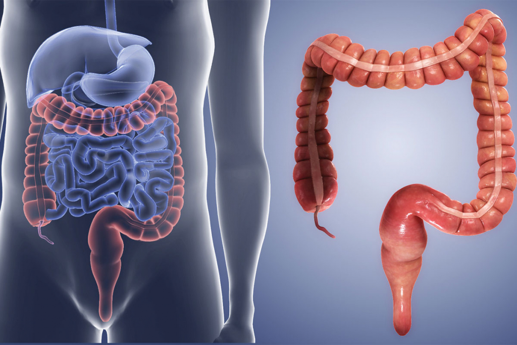 Leaky Gut. Afecțiunile intestinului, o poartă deschisă către problemele autoimune