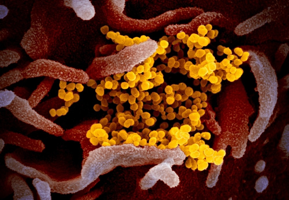 Fenomenul ia amploare - Alte două țări confirmă primele cazuri de persoane infectate cu coronavirus! Virusul ucigaș este acum prezent în 49 de țări