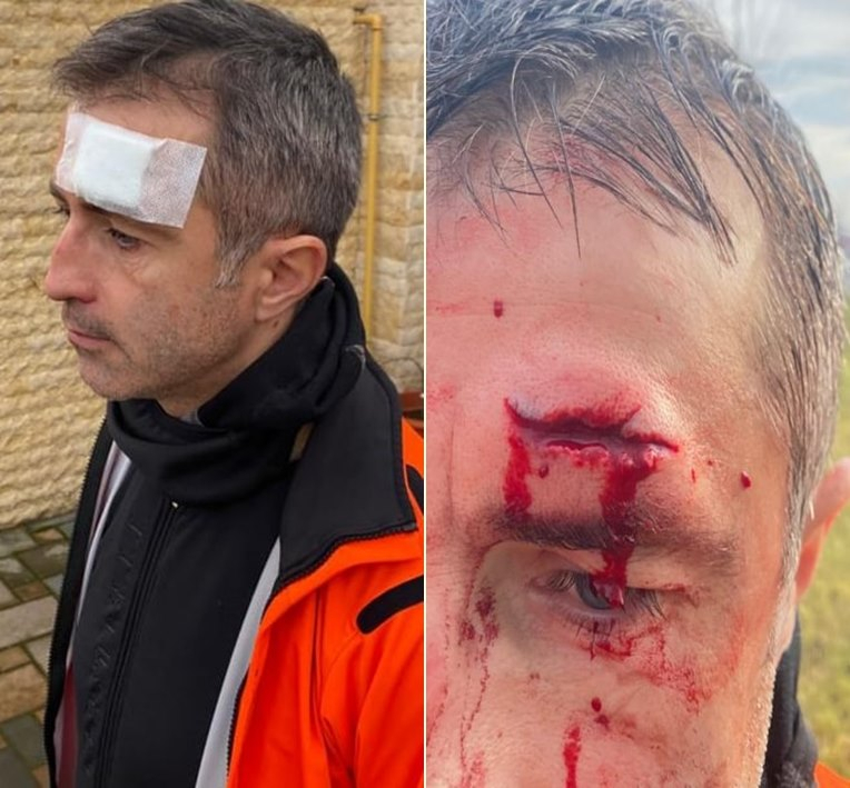 Eurodeputatul Dragoș Benea și-a spart capul. El a suferit un accident rutier