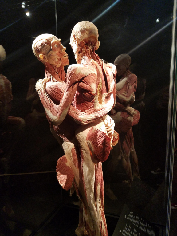 Expoziţie de cadavre umane „Body Worlds